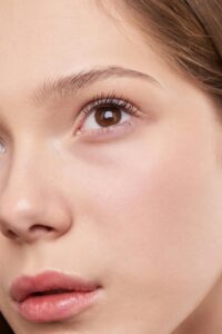 chemical peel newport beach
