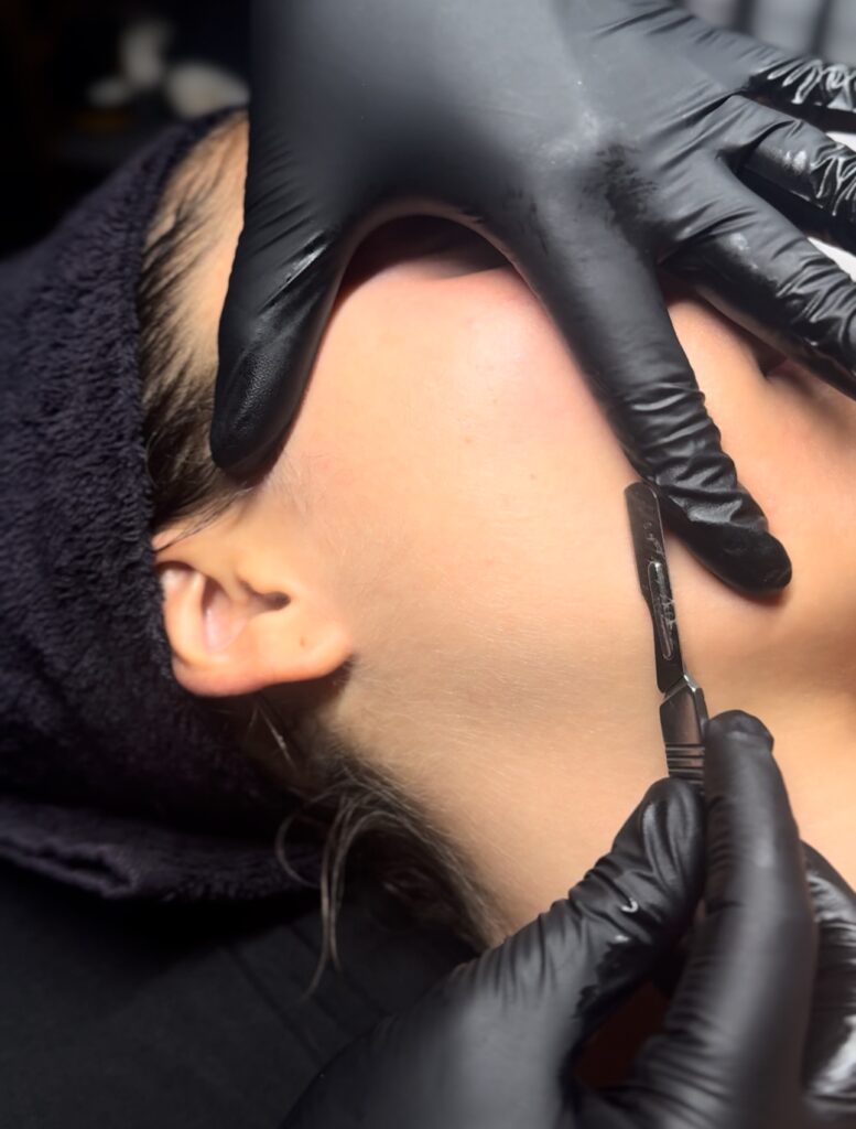 dermaplaning newport beach costa mesa orange county esthetician