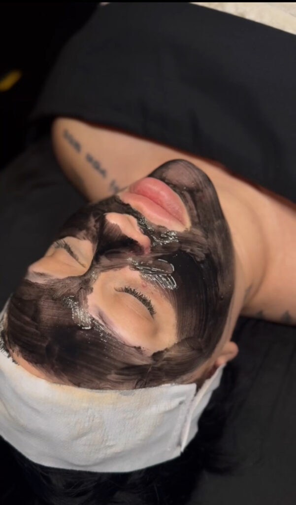 ACNE FACIAL COSTA MESA
