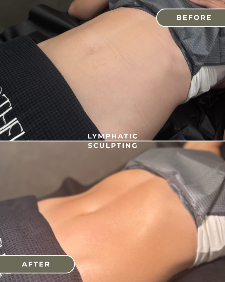 BODY SCULPTING COSTA MESA